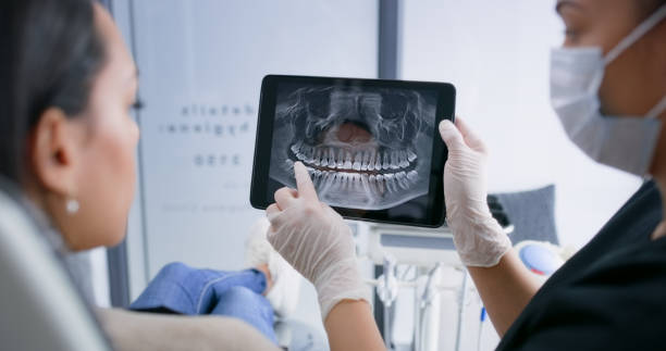 Licensed Dental Veneers service in Pottsville, AR - Smile Center Dentistry